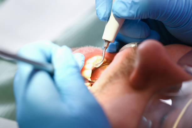 Best Emergency Care for Gum Disease in Genoa, AR